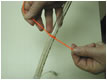 A Trinity tie being fitted to a trach-tube
