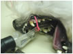 Trinity trach-tube ties in use during surgery