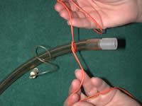 Hands securing a Trinity trach-tube tie around an endotracheal tube